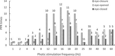 Electroclinical characteristics of photosensitive epilepsy: A retrospective study of 31 Chinese children and literature review